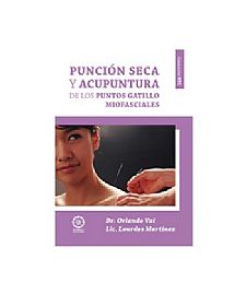 PUNCION SECA Y ACUPUNTURA